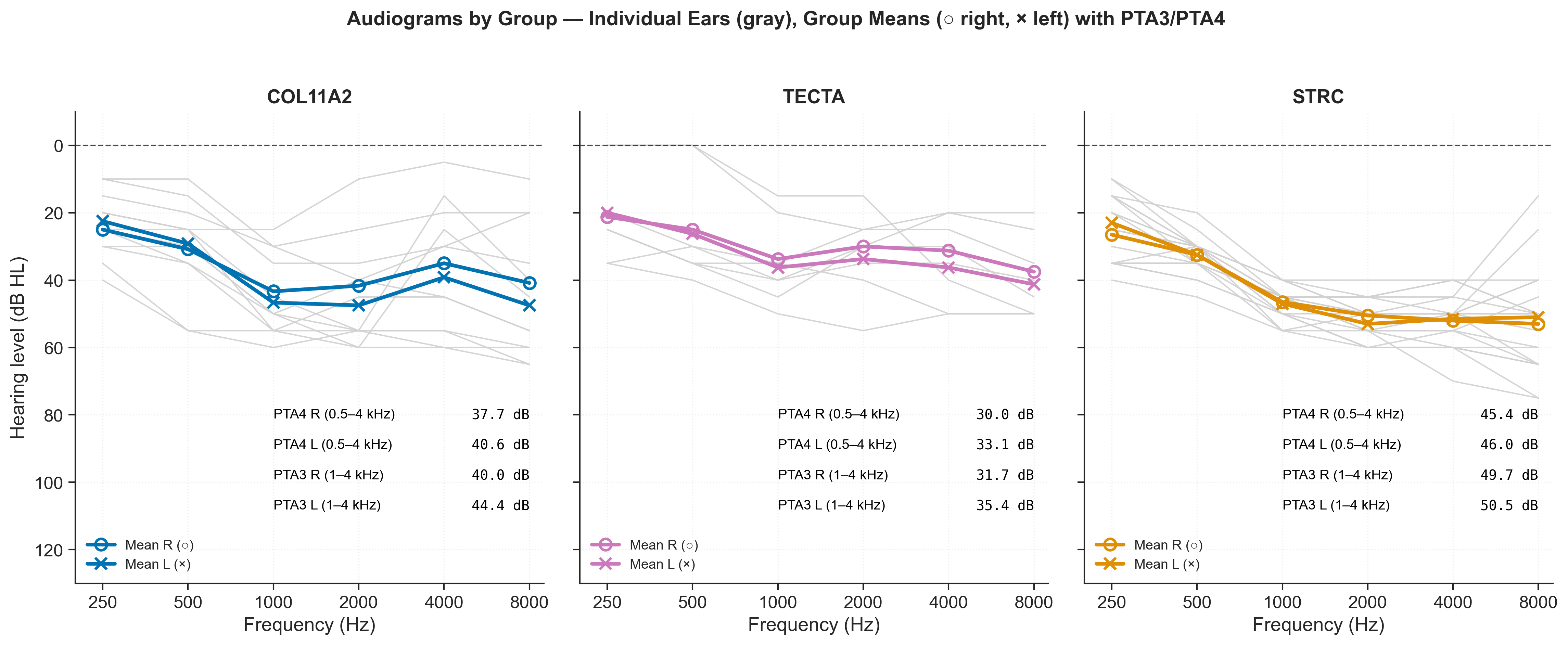 Audiograms for the three hearing-loss groups plus normal hearing